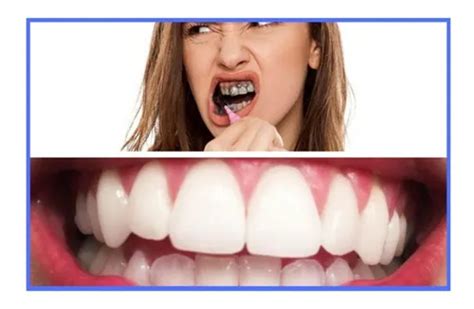 Xtradent Funciona Para Mau Hálito - 1 Clareador Carvão Ativ Xtradent Mau Halito Escova Bambu Pre | MercadoLivre