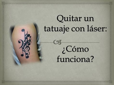 Como Quitar Un Tatuaje Ppt