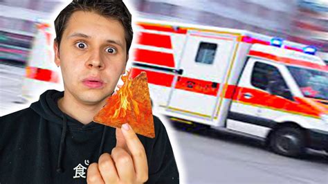 Wegen Hot Chip Challenge Im Krankenhaus Youtube