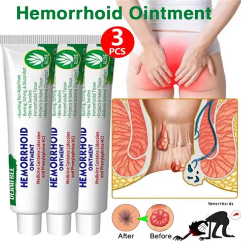3X HEMORRHOID TREATMENT Cream Haemorrhoids Piles Anal Fissure Prolapse Cream Gel 17 45