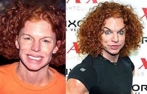 Plastic Surgery Disasters - AllDayChic