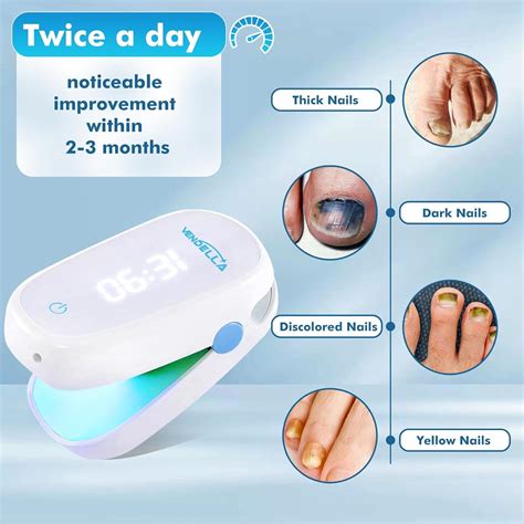 Nail Fungus Cleaning Laser Device VENDELLA Advanced Light Therapy for