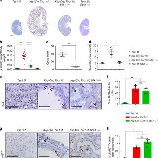 S K Deletion Protects From Cyst Formation In A Mouse Model Of Renal