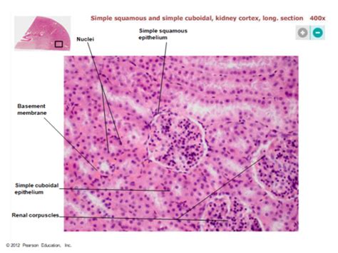 Simple Squamous Epithelium