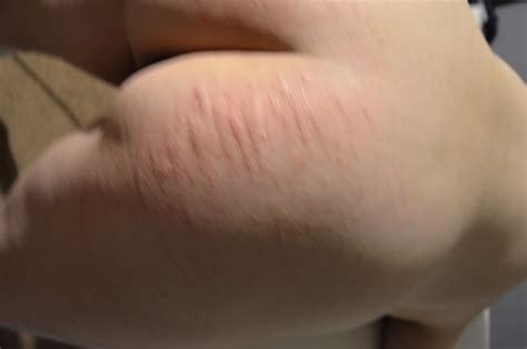 All Tied Up Nude Pics XHamster