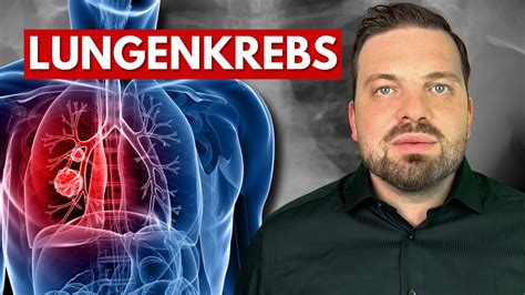 Lungenkrebs Verstehen Ursachen Symptome Diagnose Therapie YouTube