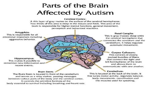 Autism Brain Diagram