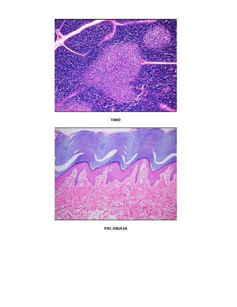 Plaquitas Histo Identificacion Para El Er Parcial Timo Piel Gruesa