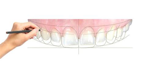 Digital Design Of The Smile Dental Aesthetics Instituto Maxilofacial