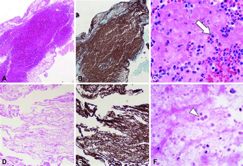 Hematoxylin And Eosin Staining Original Magnification ×40 A The