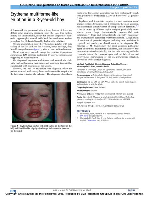 Pdf Erythema Multiforme Like Eruption In A 3 Year Old Boy