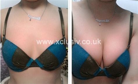 Freebra – XCLUSIV