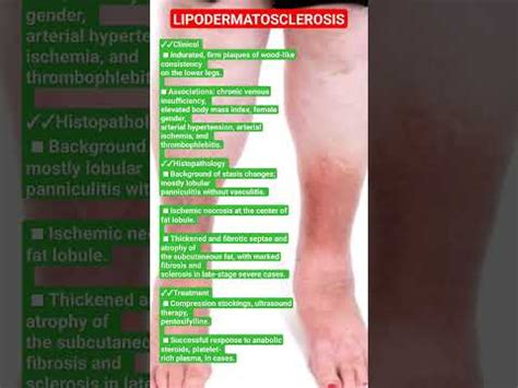 LIPODERMATOSCLEROSIS|chronic venous insufficiency #dermatology # ...
