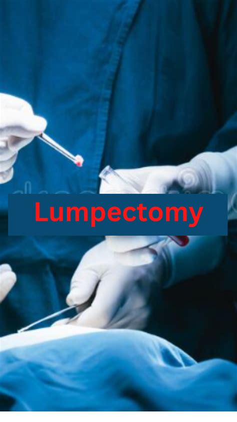 Lumpectomy Procedure Overview Purpose And Treatment Samirpandey Medium