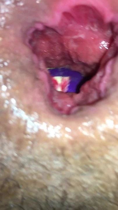 Feeding My Hungry Ass A Small Snack Gay Anal Porn XHamster