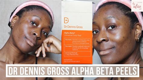 Dr Dennis Gross Alpha Beta Peels Review Demo Glowy Skin In