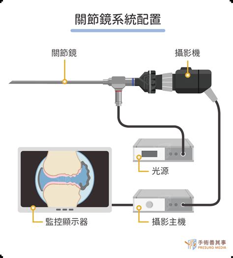 傷口小、術後恢復快 微創關節鏡手術正夯