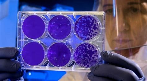 Stem Cell Research Close To Finding Type-1 Diabetes Cure In Near Future