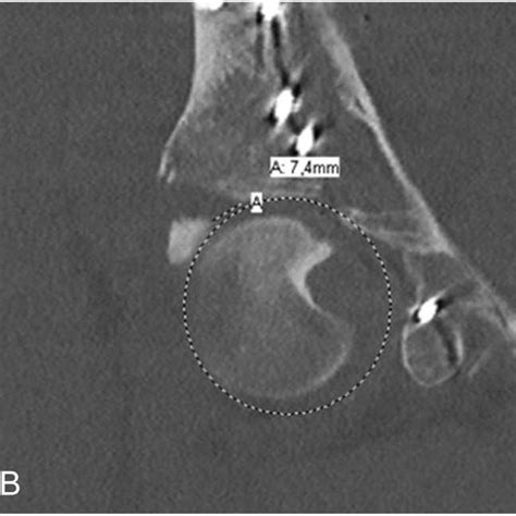 views   acetabulum showing