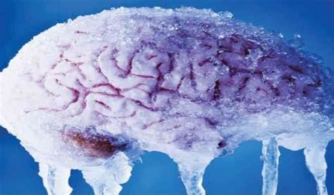 What Causes Brain Freeze Daily Trust