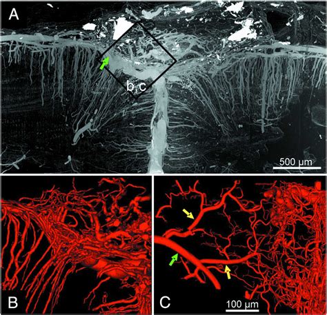 IUCr Synchrotron Radiation Micro Tomography For High Resolution