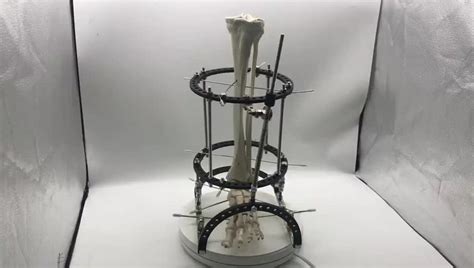 external fixator orthopedic instruments surgical fixation instrument