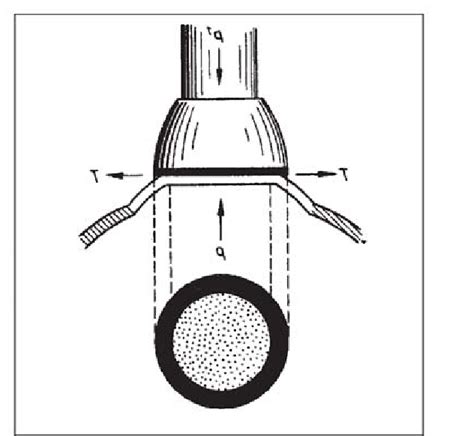 19 The Maklakov tonometer. | Download Scientific Diagram