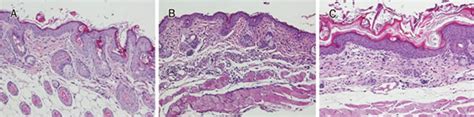 Histological Examination Of Nude Mouse Skin Stained With Hematoxylin
