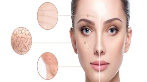 How To Remove Old Scars And Black Spots On The Legs Age Spots On Face Face Serum Dark Spots