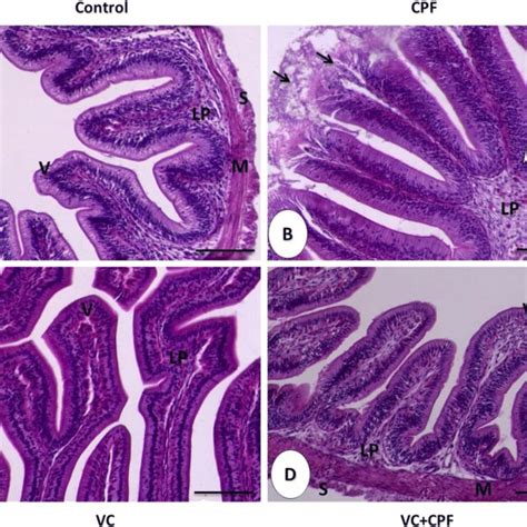 Histomicrograph Of Nile Tilapia Hepatopancreas Shows The Histological Download Scientific