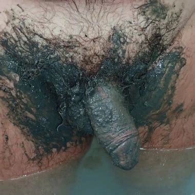 Asshole Torture Extreme Gay Man Porn Xhamster