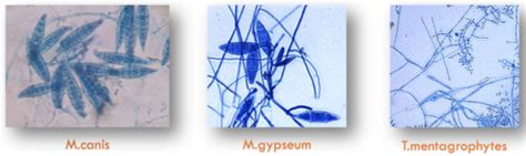 Fungal disease testing Flashcards | Quizlet