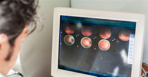 Floaters and Flashes | Retina Consultants of Nevada - Retina ... 