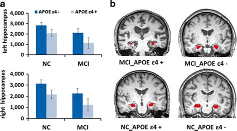 The Effect Of The Apoe ε4 × Mci Interaction On Hippocampal Volumes A