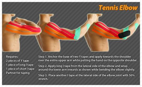 Kinesiology Taping Instructions For Tennis Elbow Ktape Ares