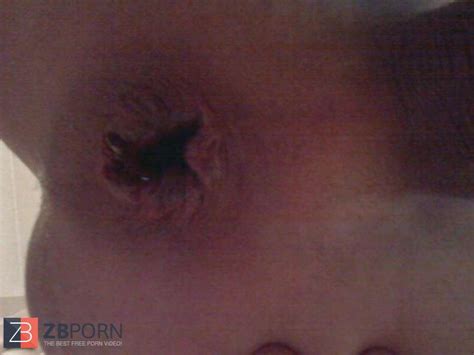 Dr Johnsons Dangled And Aftermath Zb Porn