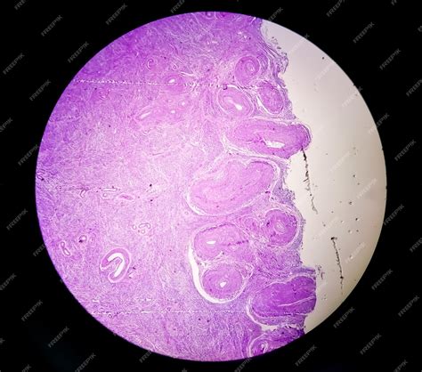 Examen histológico de biopsia de útero sugestiva de prolapso uterino