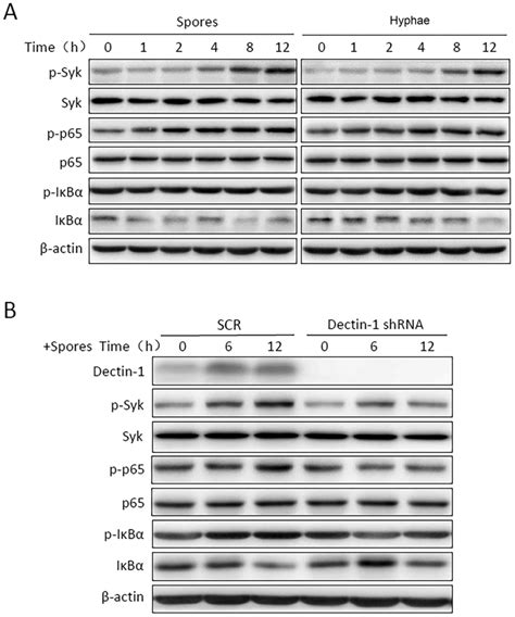 Role and mechanism of the Dectin1mediated Syk NFκB signaling pathway