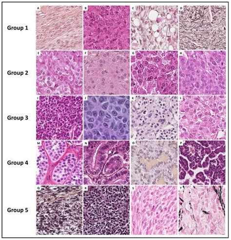 Cancers Free Full Text Relevance Of Molecular Pathology For The