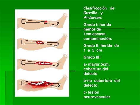 PPT - Generalidades en ortopedia PowerPoint Presentation, free download