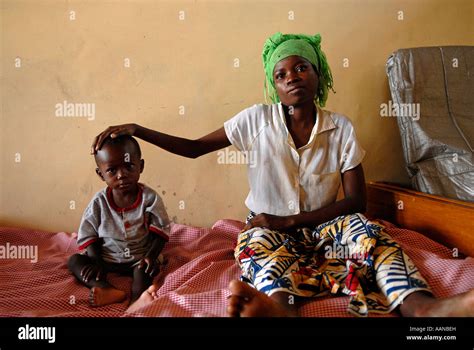 A Malnourished Child Looks Dejected At A Unicef Supported Nutrition