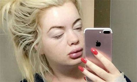 Jane Park applauded for hitting back at troll who mocked her sepsis