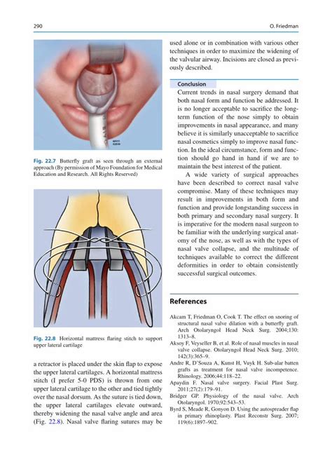 PDF Nasal Physiology And Pathophysiology Of Nasal Disorders The