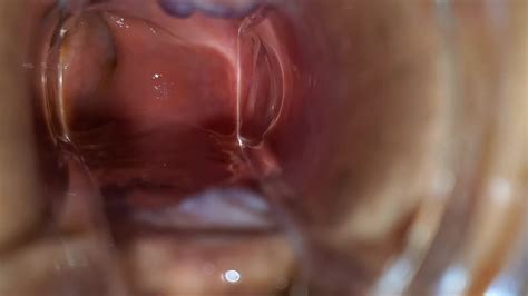 Bbw extremo anal e idiota espéculo gape RedTube