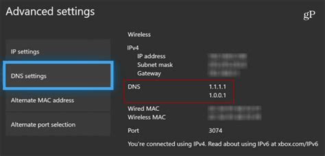 How To Change The Dns Service On Xbox One To Improve Speed And Privacy ...
