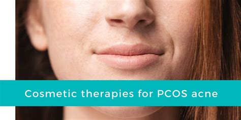 PCOS Acne Treatment | Conquer Your PCOS Naturally