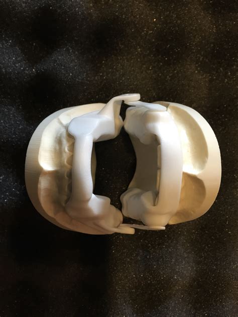 Gallery | Dynamic Dental Laboratory