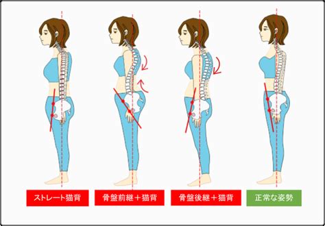 猫背矯正 天療整体施術院