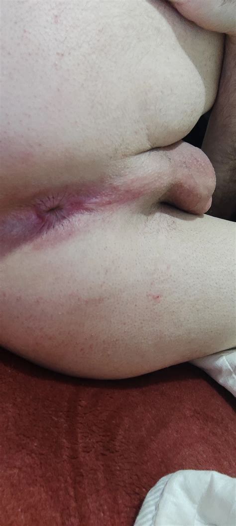 Nude Bikini Pantyhose 8 Nude Pics XHamster