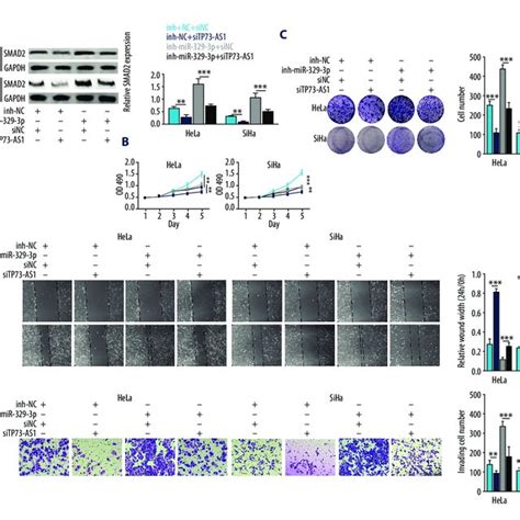 Long Noncoding Rna Lncrna Tp As Promoted Cell Proliferation By